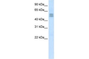 Western Blotting (WB) image for anti-LIM Homeobox Transcription Factor 1, beta (LMX1B) antibody (ABIN2461655) (LMX1B anticorps)