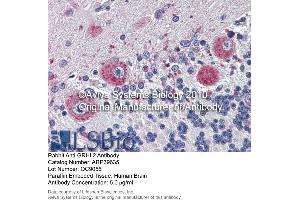 Immunohistochemistry (IHC) image for anti-Grainyhead-Like 2 (GRHL2) (Middle Region) antibody (ABIN2778358)