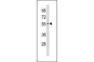 GTDC1 Antibody (Center) (ABIN1881395 and ABIN2843292) western blot analysis in Jurkat cell line lysates (35 μg/lane). (GTDC1 anticorps  (AA 278-304))