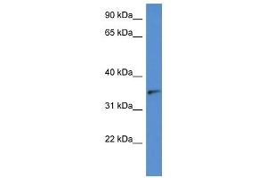 Western Blot showing SORD antibody used at a concentration of 1 ug/ml against Hela Cell Lysate (SORD anticorps  (N-Term))