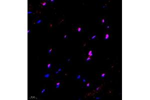 Immunofluorescence of paraffin embedded mouse Skeletal muscle using ZNF498 (ABIN7076253) at dilution of 1:650 (400x lens)