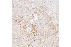 Immunohistochemistry (IHC) image for anti-ATP Synthase, H+ Transporting, Mitochondrial F1 Complex, alpha Subunit 1, Cardiac Muscle (ATP5A1) (AA 175-225) antibody (ABIN7453915)