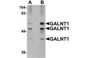 Western blot analysis of GALNT10 in rat brain tissue lysate with AP30352PU-N GALNT10 antibody at (A) 1 and (B) 2 μg/ml. (GALNT10 anticorps  (N-Term))