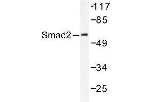 Image no. 1 for anti-SMAD, Mothers Against DPP Homolog 2 (SMAD2) antibody (ABIN271912) (SMAD2 anticorps)