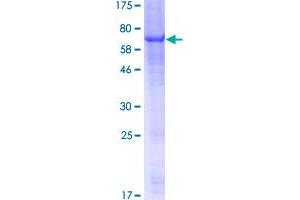 Image no. 1 for Purinergic Receptor P2X, Ligand Gated Ion Channel 2 (P2RX2) (AA 1-404) protein (GST tag) (ABIN1313804)