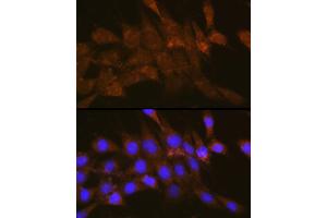 Immunofluorescence analysis of NIH-3T3 cells using OSBP Rabbit pAb (ABIN1681171, ABIN3018393, ABIN3018394 and ABIN6220458) at dilution of 1:100 (40x lens). (OSBP anticorps  (AA 508-807))