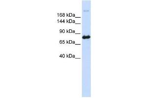 CAD antibody used at 1 ug/ml to detect target protein. (CAD anticorps  (N-Term))