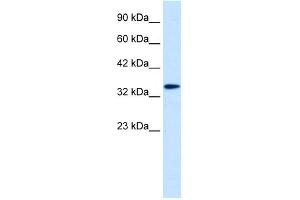 WB Suggested Anti-DLX6 Antibody Titration: 0. (DLX6 anticorps  (Middle Region))