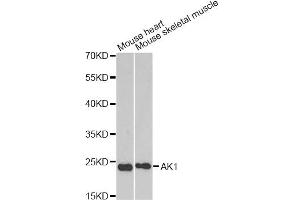 Western blot analysis of extracts of various cell lines, using AK1 antibody. (Adenylate Kinase 1 anticorps)