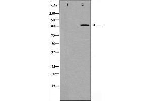 Western blot analysis of EPHB4 expression in 293 cell extract,The lane on the left is treated with the antigen-specific peptide. (EPH Receptor B4 anticorps  (Internal Region))