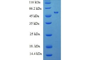 SDS-PAGE (SDS) image for Muscleblind-like Protein 1 (MBNL1) (AA 1-382) protein (His-SUMO Tag) (ABIN5711928)