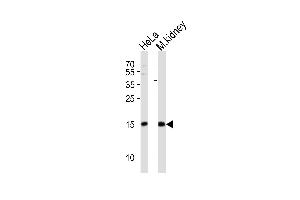 Western blot analysis of lysates from HeLa cell line, mouse kidney tissue lysate (from left to right), using CDA Antibody (C-term) (ABIN389393 and ABIN2839485). (CDA anticorps  (C-Term))
