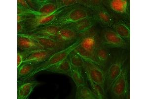 IF analysis of RBP1 using anti-RBP1 antibody (ABIN7599586) and anti-Tubulin Alpha antibody (ABIN7600339). (RBP1 anticorps  (AA 10-135))