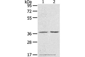 Western blot analysis of Mouse stomach tissue and A431 cell, using PDLIM4 Polyclonal Antibody at dilution of 1:800 (PDLIM4 anticorps)