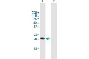 Western Blot analysis of RGS10 expression in transfected 293T cell line by RGS10 MaxPab polyclonal antibody. (RGS10 anticorps  (AA 1-181))