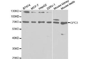 Western blot analysis of extracts of various cell lines, using GPC3 antibody (ABIN5971006) at 1/1000 dilution. (Glypican 3 anticorps)