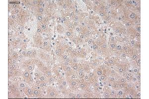 Immunohistochemical staining of paraffin-embedded liver tissue using anti-PROM2mouse monoclonal antibody. (Prominin 2 anticorps)