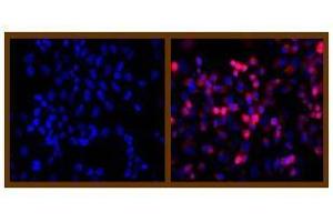 Immunofluorescence (IF) image for anti-His Tag antibody (ABIN126947) (His Tag anticorps)