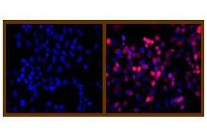 Immunofluorescence (IF) image for anti-His Tag antibody (ABIN126947)