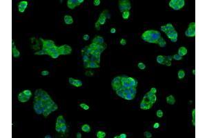 Immunofluorescence (IF) image for anti-Sorbitol Dehydrogenase (SORD) antibody (ABIN1501072) (SORD anticorps)