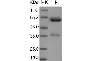 Western Blotting (WB) image for Epithelial Cell Adhesion Molecule (EPCAM) protein (Fc Tag) (ABIN7321141)