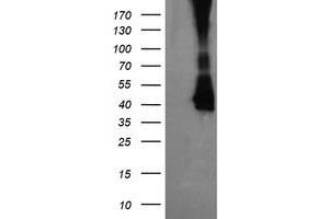 Image no. 3 for anti-Mitogen-Activated Protein Kinase Kinase 3 (MAP2K3) antibody (ABIN1499400)