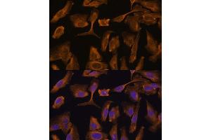 Immunofluorescence analysis of U-2 OS cells using MTMR4 Polyclonal Antibody (ABIN7268764) at dilution of 1:100 (40x lens). (MTMR4 anticorps  (AA 920-1195))