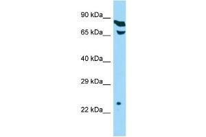 Host: Rabbit Target Name: THOC7 Sample Type: HepG2 Whole Cell lysates Antibody Dilution: 1. (THOC7 anticorps  (C-Term))