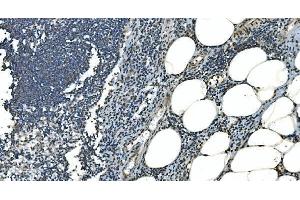 IHC analysis of LSM8 using anti-LSM8 antibody (ABIN7599579). (NAA38 anticorps  (AA 1-96))