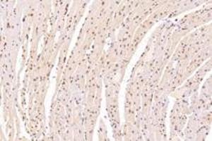 Immunohistochemistry analysis of paraffin-embedded mouse heart using,SUN2 (ABIN7075502) at dilution of 1: 4000 (SUN2 anticorps)