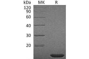 Western Blotting (WB) image for Fibroblast Growth Factor 2 (Basic) (FGF2) (Active) protein (ABIN7321251) (FGF2 Protéine)