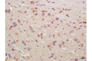 Formalin-fixed and paraffin embedded rat brain labeled with Anti-CHRM4/mAChR M4 Polyclonal Antibody, Unconjugated (ABIN1387838) at 1:200, followed by conjugation to the secondary antibody and DAB staining (CHRM4 anticorps  (AA 1-31))