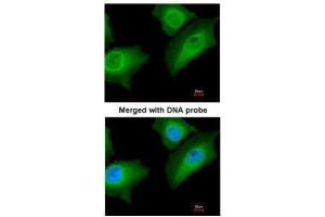 ICC/IF Image Immunofluorescence analysis of paraformaldehyde-fixed HeLa, using Annexin A1, antibody at 1:200 dilution. (Annexin a1 anticorps)