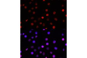 Immunofluorescence analysis of C6 cells using TCF4 Rabbit pAb (ABIN3021529, ABIN3021530, ABIN3021531, ABIN1513591 and ABIN6215200) at dilution of 100 (40x lens).