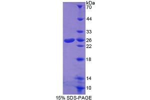 Image no. 1 for ATP-Binding Cassette, Sub-Family A (ABC1), Member 8 (ABCA8) (AA 1263-1456) protein (T7 tag,His tag) (ABIN6239304)