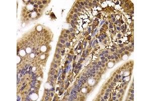 Immunohistochemistry of paraffin-embedded Mouse ileum using CLASP1 Polyclonal Antibody at dilution of 1:100 (40x lens). (CLASP1 anticorps)