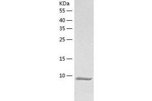 Western Blotting (WB) image for DPH3, KTI11 Homolog (S. Cerevisiae) Pseudogene 1 (DPH3P1) (AA 1-78) protein (His tag) (ABIN7122705) (DPH3P1 Protein (AA 1-78) (His tag))