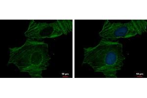 ICC/IF Image alpha Actin (cardiac muscle) antibody detects alpha Actin (cardiac muscle) protein at cytoskeleton by immunofluorescent analysis.
