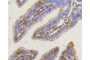 Immunohistochemistry of paraffin-embedded mouse intestin using PRKCA antibody (ABIN4904772) at dilution of 1:100 (40x lens). (PKC alpha anticorps)