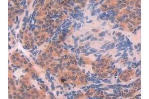 Detection of XDH in Mouse Ovary Tissue using Polyclonal Antibody to Xanthine Dehydrogenase (XDH)