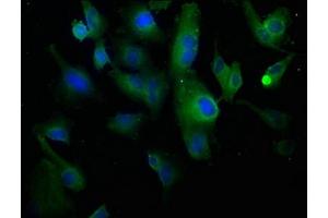 Immunofluorescence staining of U251 cells with ABIN7139779 at 1:100, counter-stained with DAPI.