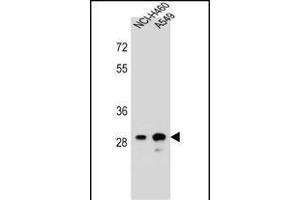 anti-Dehydrogenase/reductase (SDR Family) Member 4 Like 1 (DHRS4L1) (AA 222-250), (C-Term) antibody