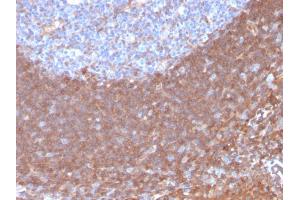 Formalin-fixed, paraffin-embedded human Tonsil stained with Calpastatin Mouse Monoclonal Antibody (CAST/1550).