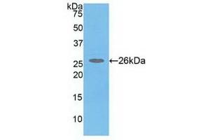 Detection of Recombinant COMT, Human using Polyclonal Antibody to Catechol-O-Methyltransferase (COMT) (COMT anticorps  (AA 52-271))