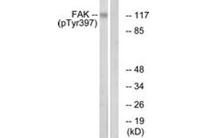 Western blot analysis of extracts from Jurkat cells treated with Ca2+ 40nM 30', using FAK (Phospho-Tyr397) Antibody. (FAK anticorps  (pTyr397))