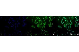 Immunocytochemistry/Immunofluorescence analysis using Rabbit Anti-Ubiquitin Polyclonal Antibody . (Ubiquitin anticorps  (HRP))