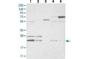 Western blot analysis of Lane 1: RT-4, Lane 2: U-251 MG, Lane 3: Human Plasma, Lane 4: Liver, Lane 5: Tonsil with HINT3 polyclonal antibody  at 1:250-1:500 dilution. (HINT3 anticorps)
