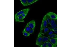 Immunofluorescence analysis of MCF-7 cells using RELB mouse mAb (green).