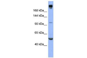 WB Suggested Anti-INSR Antibody Titration:  0. (Insulin Receptor anticorps  (Middle Region))