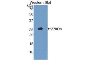 Western Blotting (WB) image for anti-Toll-Like Receptor 6 (TLR6) (AA 608-796) antibody (ABIN3208098) (TLR6 anticorps  (AA 608-796))